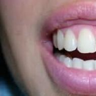 Сломанный зуб во сне что означает
